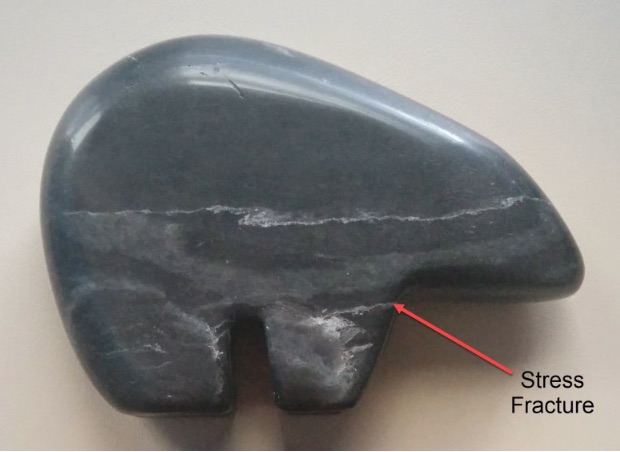 Stress Fractures
