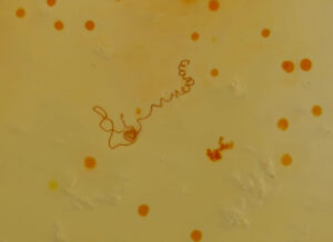 Thread inclusion in agate